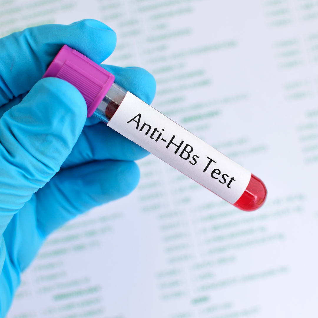 Hepatitis B Surface Antibody Test Time